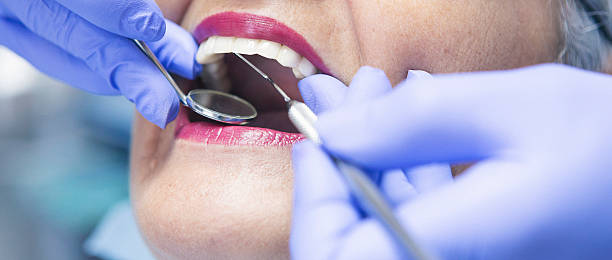 Best Emergency Dental Care for Sports Injuries in Center Point, TX